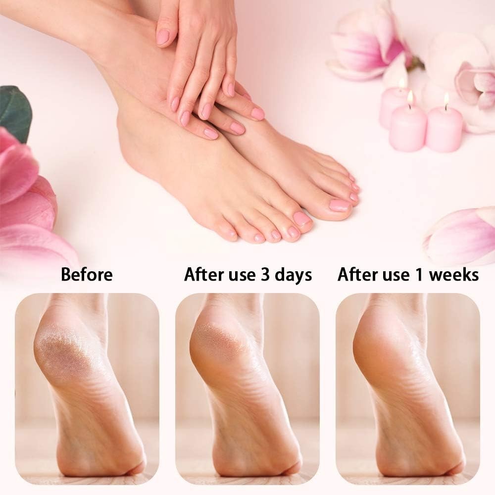 Callus Remover with LED Display Cordless Rechargeable Electric Feet Callus