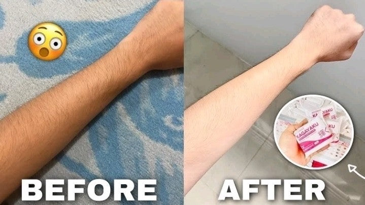 ROSMAR KAGAYAKU SOAP 70g 10x Scar Instant Remover
