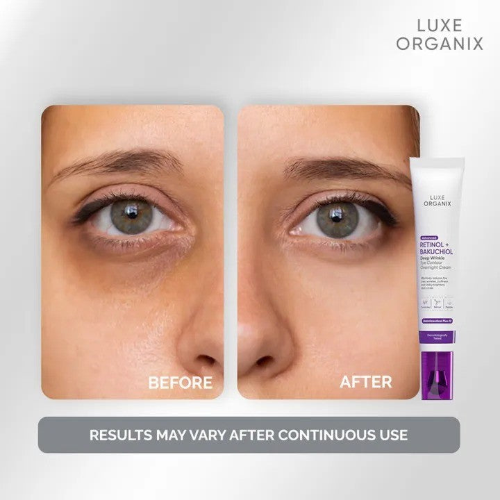 LUXE ORGANIX Retinol + Bakuchiol Deep Wrinkle Eye Contour Overnight Cream 12g