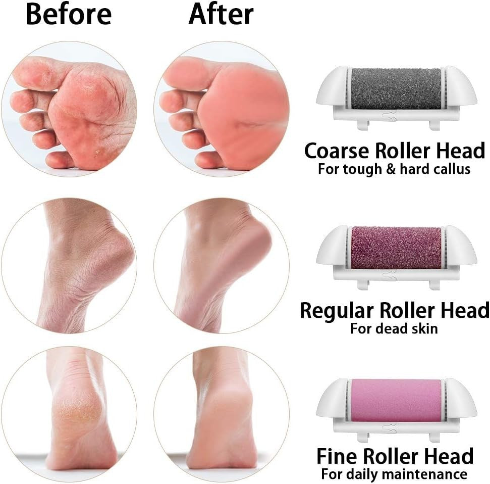 Callus Remover with LED Display Cordless Rechargeable Electric Feet Callus