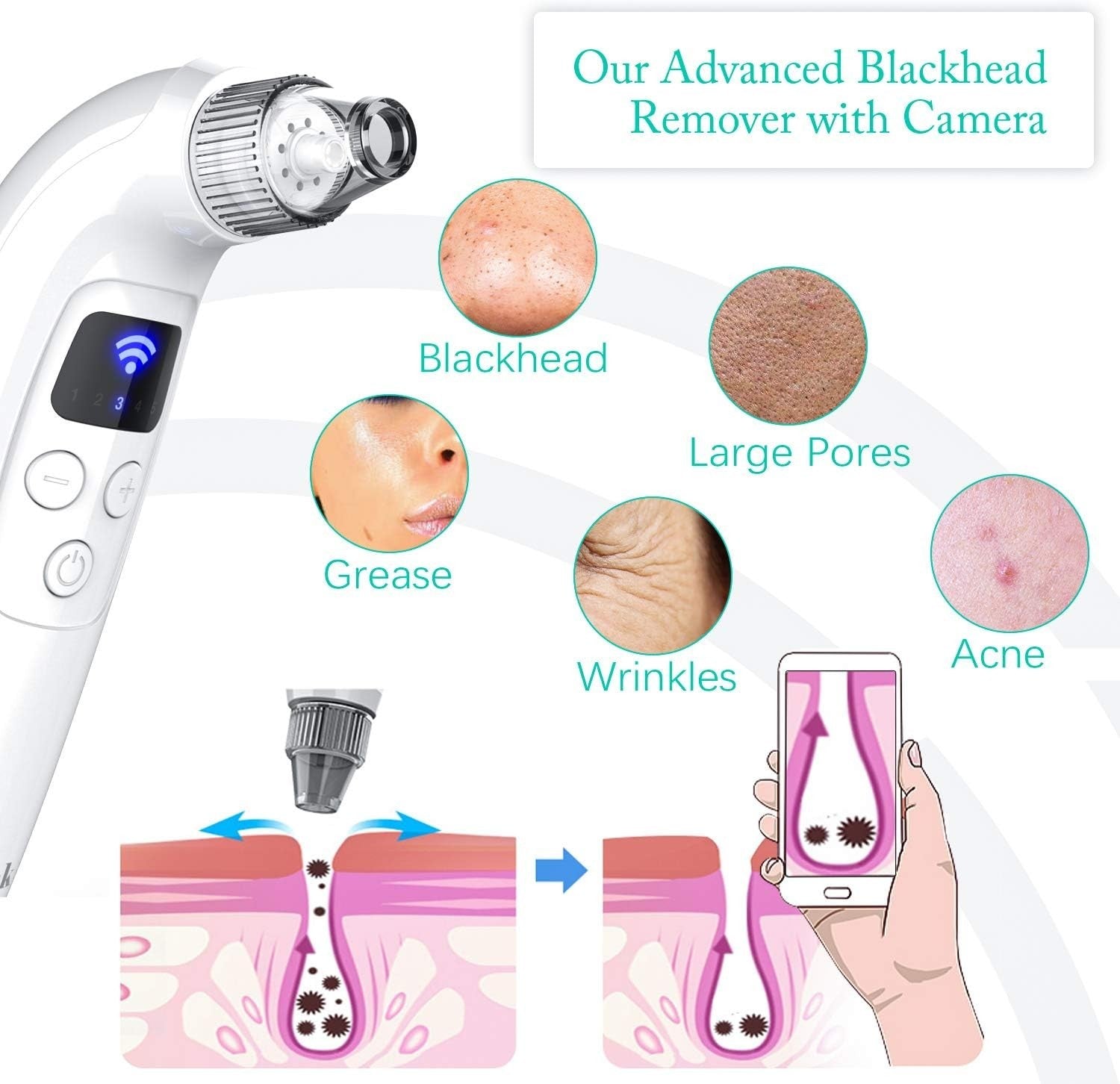 Oiiwak 5MP Visible Blackhead Vacuum, Blackhead Remover with Camera, Electric WiF