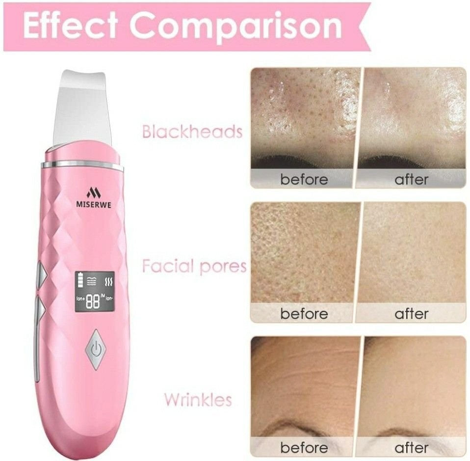 Skin Scrubber with LCD Display Skin Spatula Pore Cleaner Blackhead Remover Face