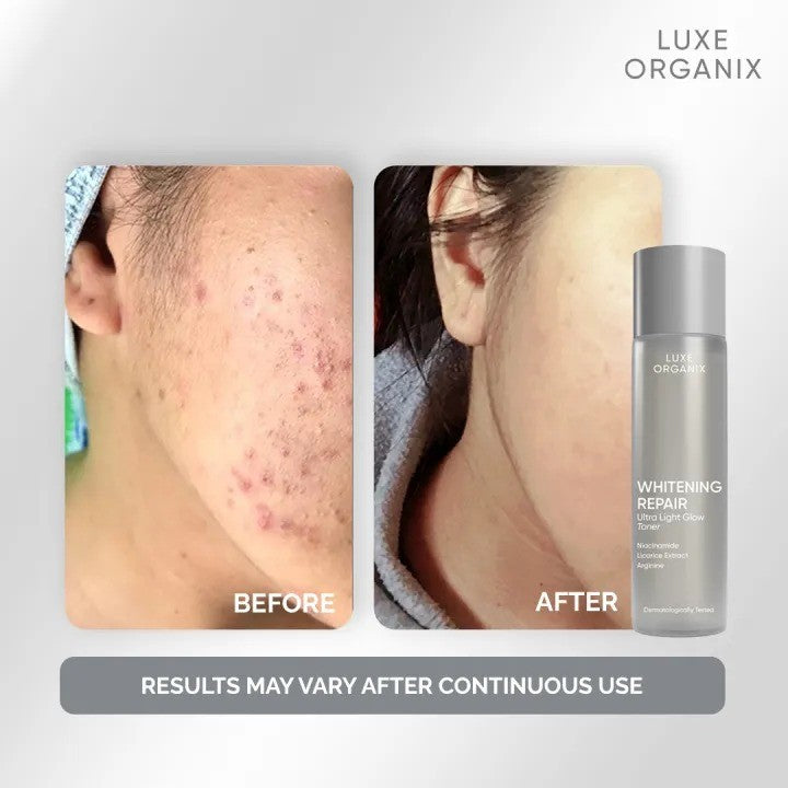 Luxe Organix Whitening Repair Essence Toner Niacinamide Licorice Extract 150ml
