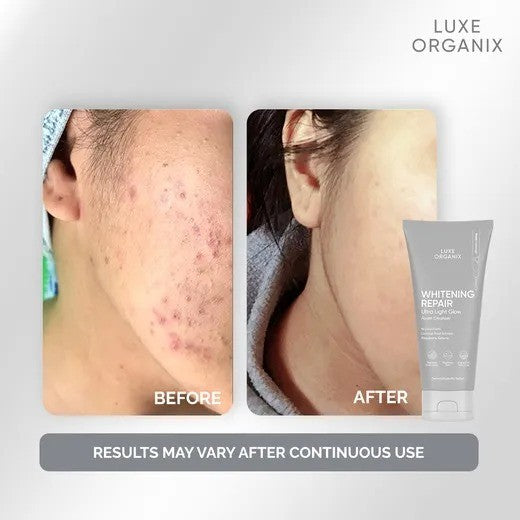 LUXE ORGANIX Whitening Repair Ultra Light Glow Foam Cleanser 150mL