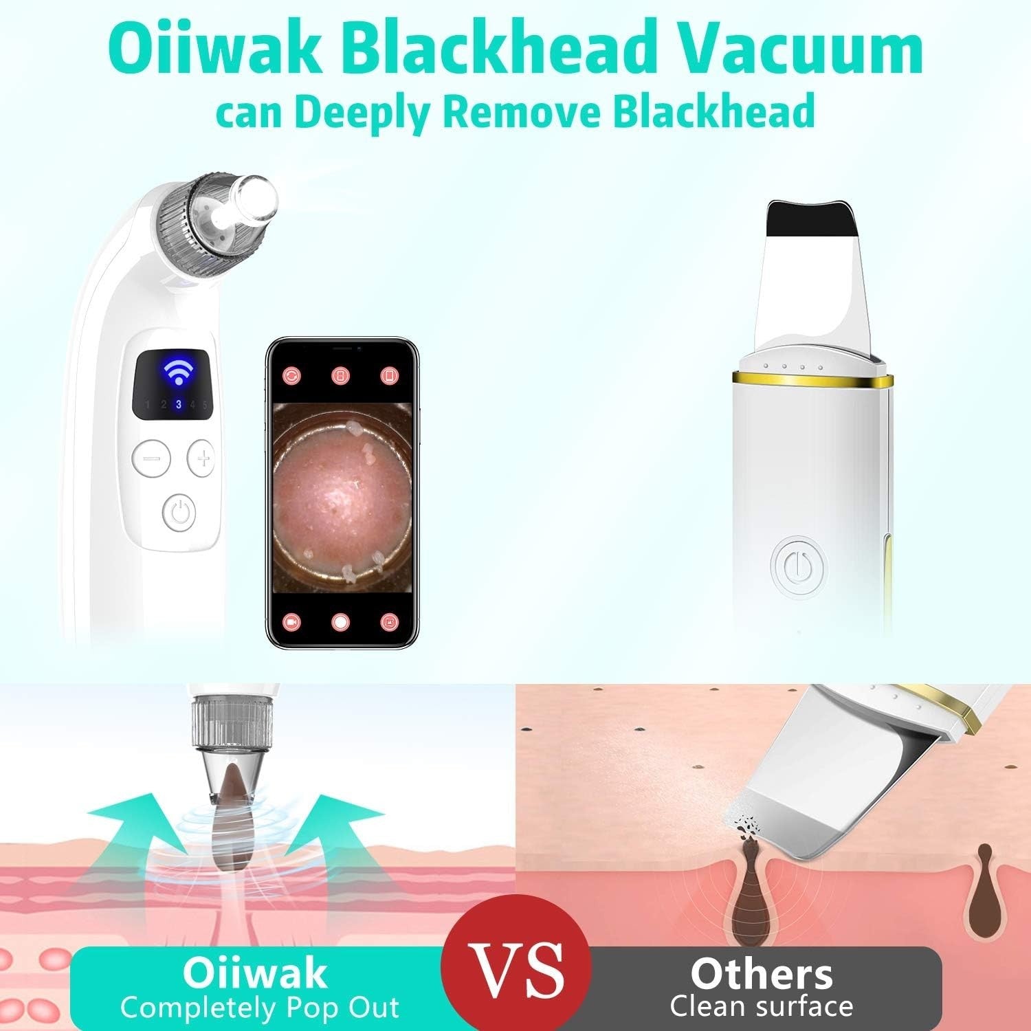 Oiiwak 5MP Visible Blackhead Vacuum, Blackhead Remover with Camera, Electric WiF